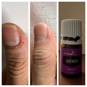 薰衣草修復傷口*